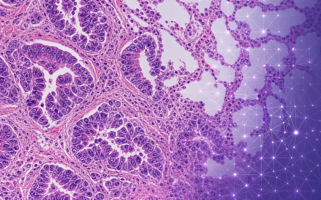 Lung Cancer Histopathology Classification with Basic CNN & DenseNet-121